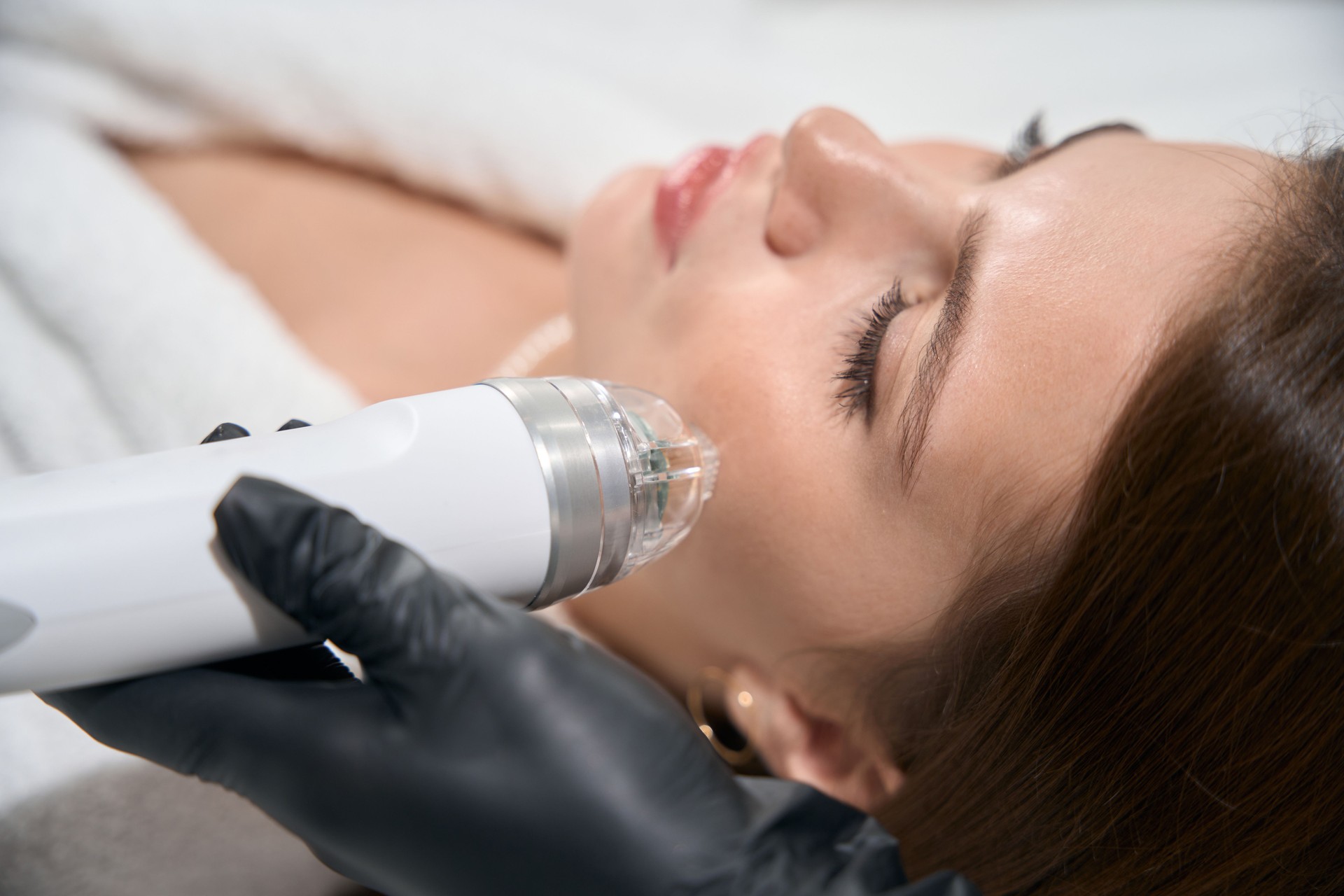 Beautician doing microneedle rf lifting of woman face in beauty salon