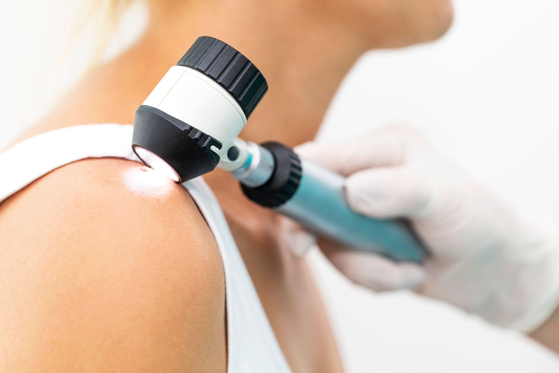 Examen dermatologic